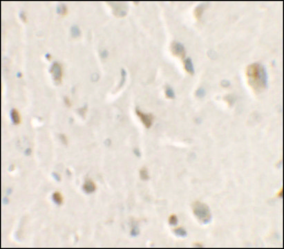 Anti-ULK1 antibody produced in rabbit
