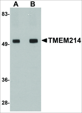 Anti-TMEM214 antibody produced in rabbit