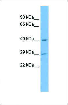Anti-NAT15 antibody produced in rabbit