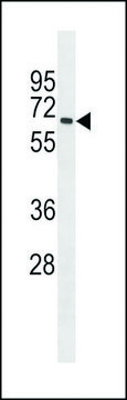 ANTI-MBOAT7 (CENTER) antibody produced in