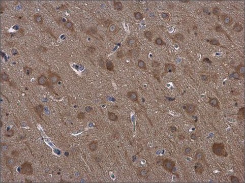 Anti-RPS3 antibody produced in rabbit