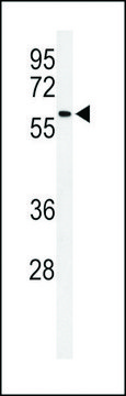 ANTI-SDR (CENTER) antibody produced in