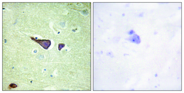 Anti-IGF2R antibody produced in rabbit