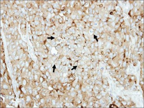 Anti-LAMP2 antibody produced in rabbit