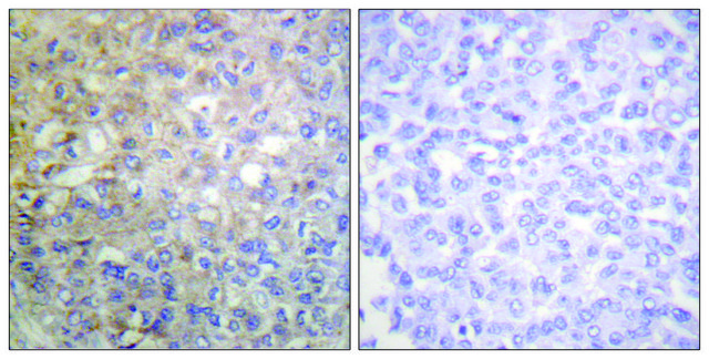 Anti-FGFR1 antibody produced in rabbit