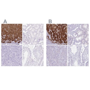 Anti-CYP21A2 antibody produced in rabbit