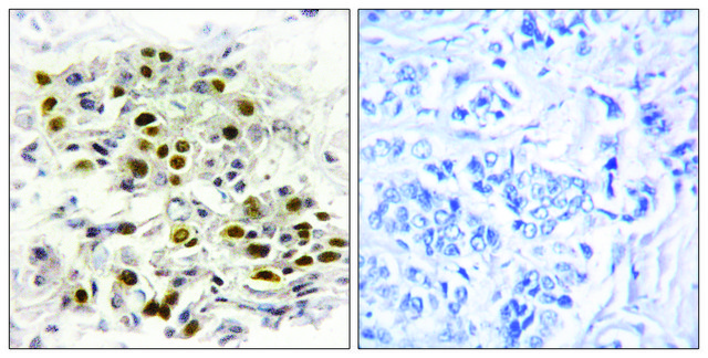 Anti-MAP3K6 antibody produced in rabbit