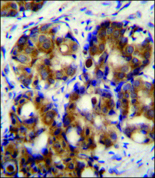 ANTI-HMMR (C-TERM) antibody produced in