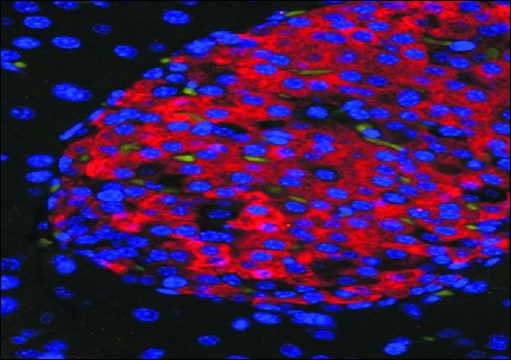 Anti-UNC5C antibody produced in goat