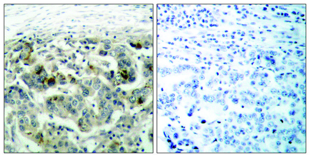 Anti-NF-?B p105 antibody produced in