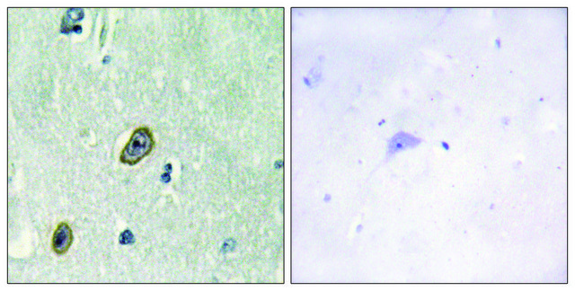 Anti-KCIP1 antibody produced in rabbit