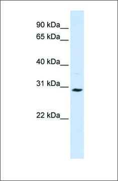 Anti-SLC25A20 antibody produced in rabbit