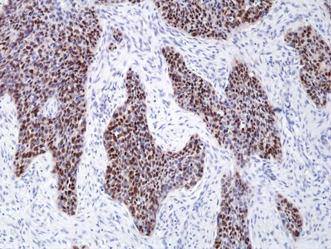 Anti-SOX2 Rabbit Monoclonal Antibody