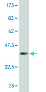 Monoclonal Anti-CDKL3 antibody produced in
