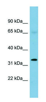 Anti-HEY1 antibody produced in rabbit