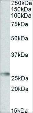 Anti-HLA-DQA2 antibody produced in goat