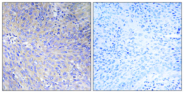 Anti-MRPL11 antibody produced in rabbit