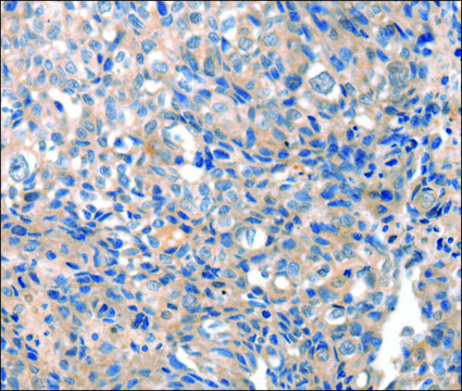 Anti-GRIN2D antibody produced in rabbit