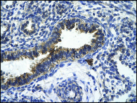 Anti-ZFR antibody produced in rabbit