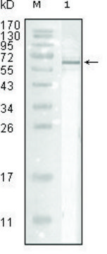 Monoclonal Anti-Influenza A virus Nucleoprotein