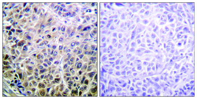 Anti-DAPK1 antibody produced in rabbit