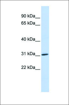 Anti-ARD1A antibody produced in rabbit