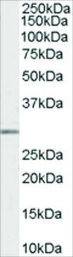 Anti-MMP7 antibody produced in goat
