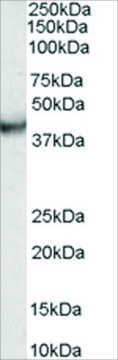 Anti-VPS37C antibody produced in goat