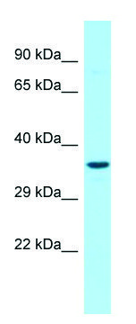 Anti-G6PC3 (N-terminal) antibody produced in
