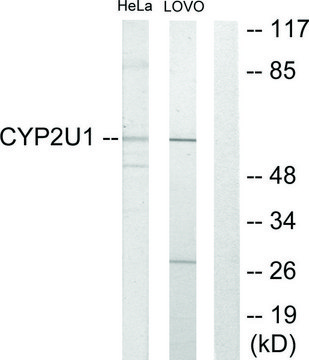 Anti-Cytochrome P450 2U1 antibody produced