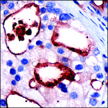 Anti-PSMA antibody, Rabbit monoclonal