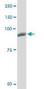 Monoclonal Anti-PYGM antibody produced in
