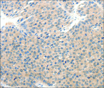Anti-SCN10A antibody produced in rabbit