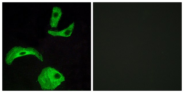 Anti-GPR18 antibody produced in rabbit