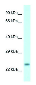 Anti-RND1 (C-terminal) antibody produced in