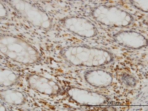 Monoclonal Anti-SEPHS2 antibody produced in
