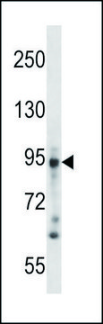 ANTI-DSG3 (N-TERM) antibody produced in
