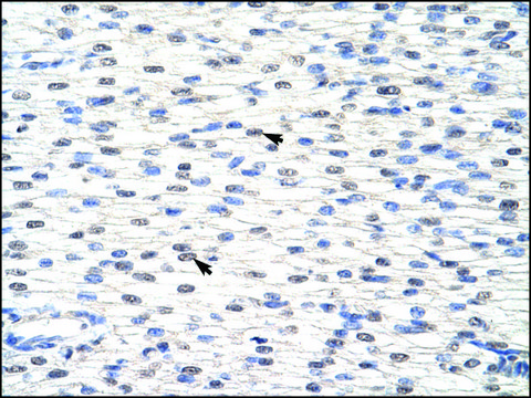 Anti-SNRPF antibody produced in rabbit