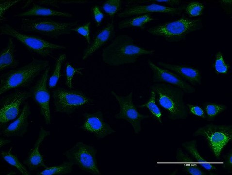 Anti-AK3L1 antibody produced in mouse