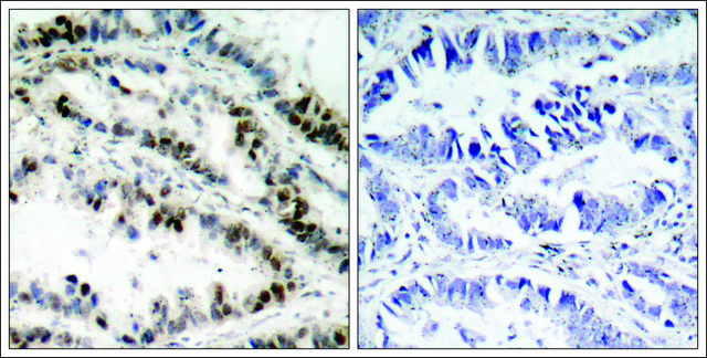 Anti-phospho-SMC1A (pSer???) antibody produced in