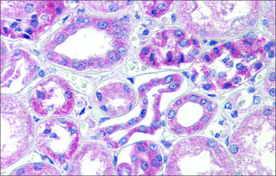 Anti-TRIM68 antibody produced in rabbit