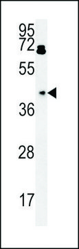 ANTI-BDHA1 (CENTER) antibody produced in