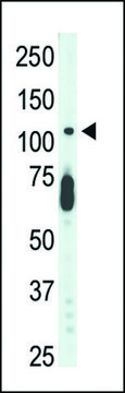 ANTI-CDKL5 (STK9)(C-TERMINAL) antibody produced in