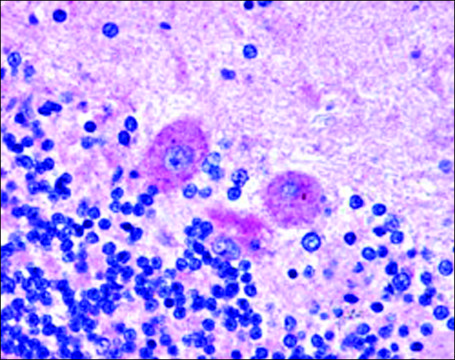 Anti-SNX26/TCGAP, C-Terminal antibody produced in