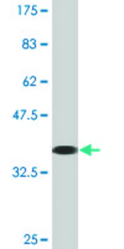 Monoclonal Anti-FLJ14981 antibody produced in