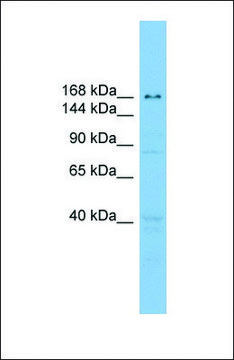 Anti-UBE2O antibody produced in rabbit