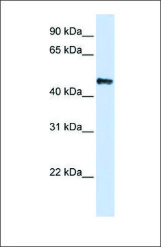 Anti-CSDA antibody produced in rabbit