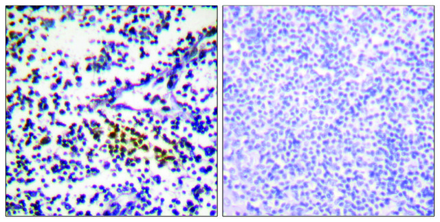 Anti-NYREN18 antibody produced in rabbit