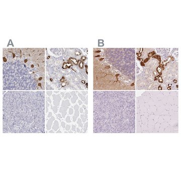 Anti-CALB1 antibody produced in rabbit