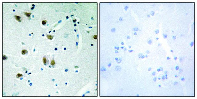 Anti-ZNF148, N-Terminal antibody produced in